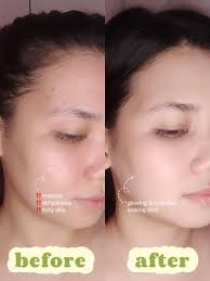 celimax The Vita A Retinal Shot Tightening Booster 15mL extra image