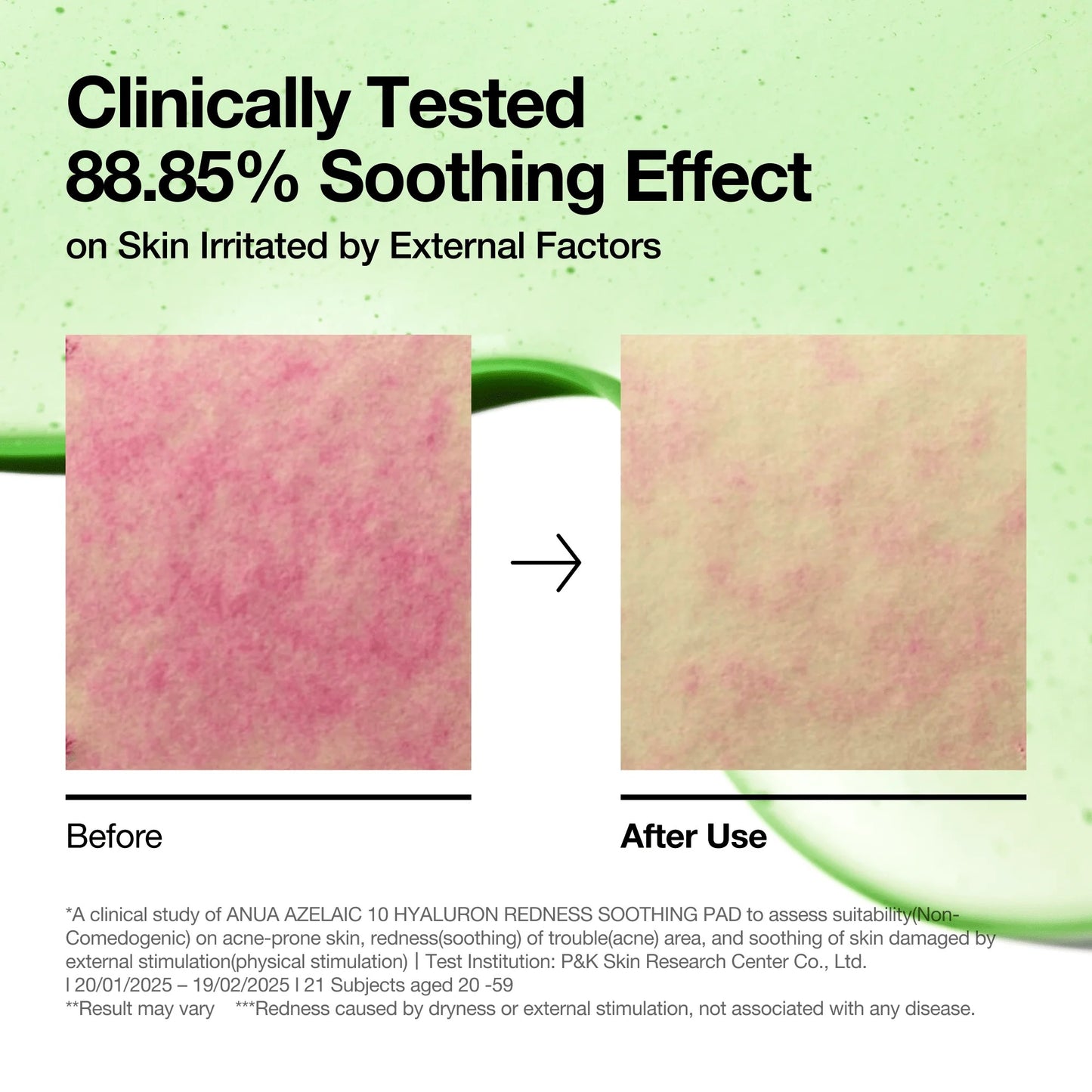 Anua Azelaic 10 Hyaluron Redness Soothing 90 Pads